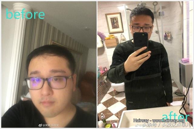 ���P�]��脱发�x��H�n�L东��������发�I还�����ǩ��P��发�F�H